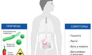 Как лечить дуоденит двенадцатиперстной кишки