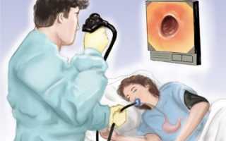 Как готовиться к гастроскопии желудка взрослому