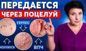 Какие болезни передаются через слюну