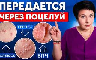 Какие болезни передаются через слюну