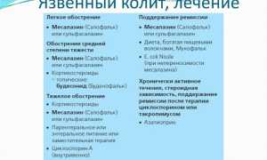 Язвенный колит — что это такое и как лечить