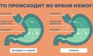 Может ли быть изжога от молока?