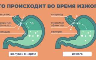 Может ли быть изжога от молока?