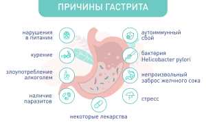 Острый гастрит: симптомы и лечение у взрослых