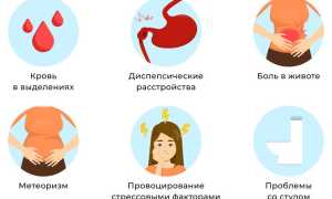 Спастический колит кишечника: симптомы и лечение