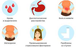 Спастический колит кишечника: симптомы и лечение