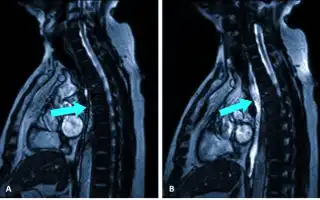 МРТ пищевода: показания, как делают исследование, что показывает, подготовка