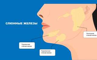Сиалоаденит подчелюстной слюнной железы — клиника, диагностика и лечение