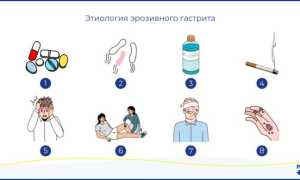 Эрозивный гастрит: лечение медикаментозными средствами