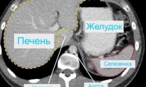 КТ желудка: что показывает