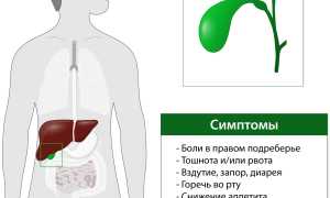 Лечение дискинезии желчного пузыря у взрослых по гипомоторному и гипермоторному типу