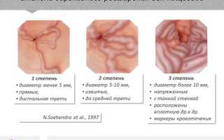 Кровотечение из расширенных вен пищевода
