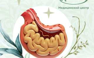 Атрофический гастрит: симптомы и лечение, прогноз для жизни