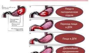 Что делает соляная кислота в желудке и для чего она нужна