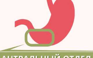 Антральный гастрит: что это такое, симптомы, лечение, диагностика