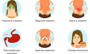 Рефлюкс-гастрит: симптомы и лечение