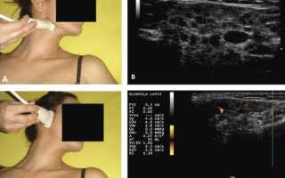 Что показывает УЗИ слюнных желез? Обследование околоушной, подчелюстной и подъязычных слюнных желез: норма и патология