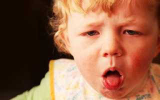 Ларингит – опасное воспаление гортани у грудничка. Как распознать болезнь и вовремя оказать помощь малышу?