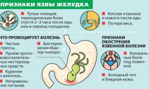 Прободная язва желудка: признаки, симптомы и лечение