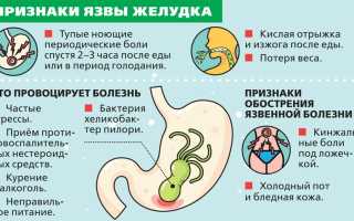 Прободная язва желудка: признаки, симптомы и лечение