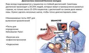 Язвенная болезнь желудка и двенадцатиперстной кишки: лечение