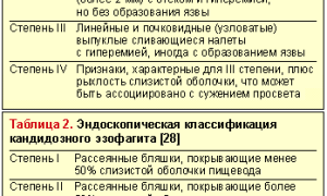 Кандидоз пищевода: лечение и причины микоза. Чем лечить грибок на слизистой?