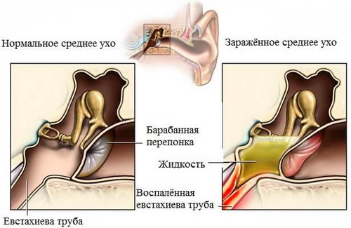 Евстахиит